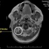 MRI Scan 3