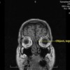 MRI Scan 4