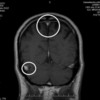 MRI Scan 10