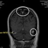 MRI Scan 12